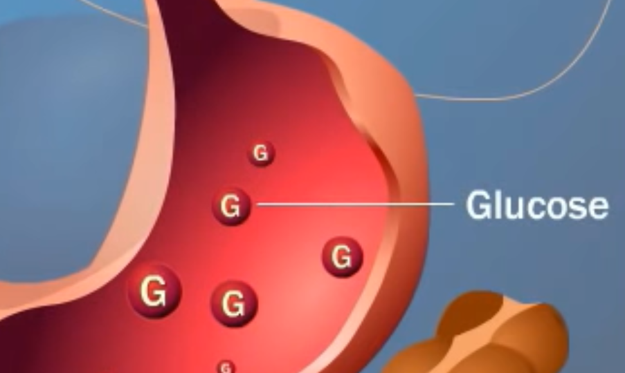 glucose2